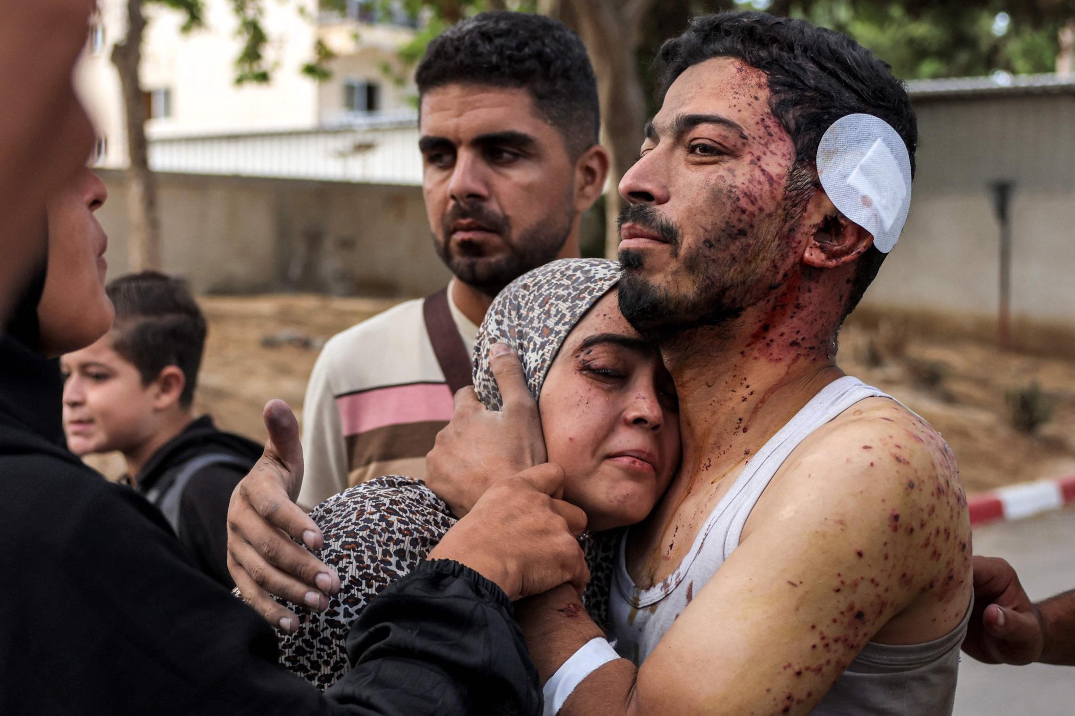 An injured man comforts a woman during a funeral for victims killed in Israeli bombardment in Khan Younis, southern Gaza Strip, Palestine, Oct. 2, 2024. (AFP Photo)