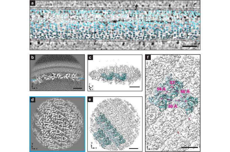 High-resolution images of RSV may expose stubborn virus's weak points