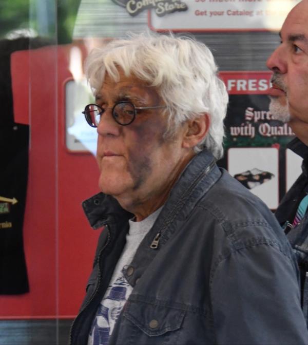 Jay Leno with a large bruise on his face at an In-N-Out Burger in Burbank, California on Nov. 21, 2024.