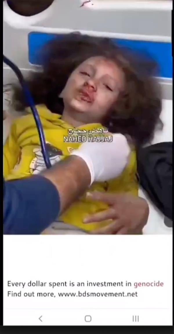 An injured, bleeding child seen getting medical attention, in a screenshot from a pro-Palestine BDS campaign.